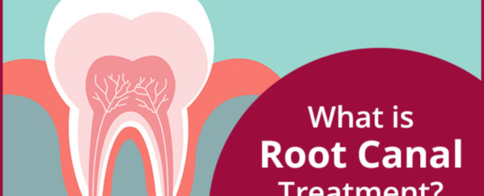 Root Canal Treatment?