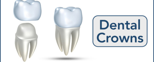 Which one you need – Dental Crowns or Implants