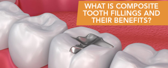 What is Composite tooth fillings and their Benefits?