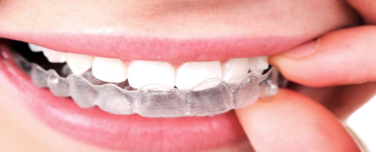 Is Invisalign the right option for you?