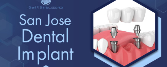 Different Types & Techniques of Implant Dentistry