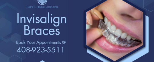 Know whether Invisalign braces in San Jose are right for you or not!