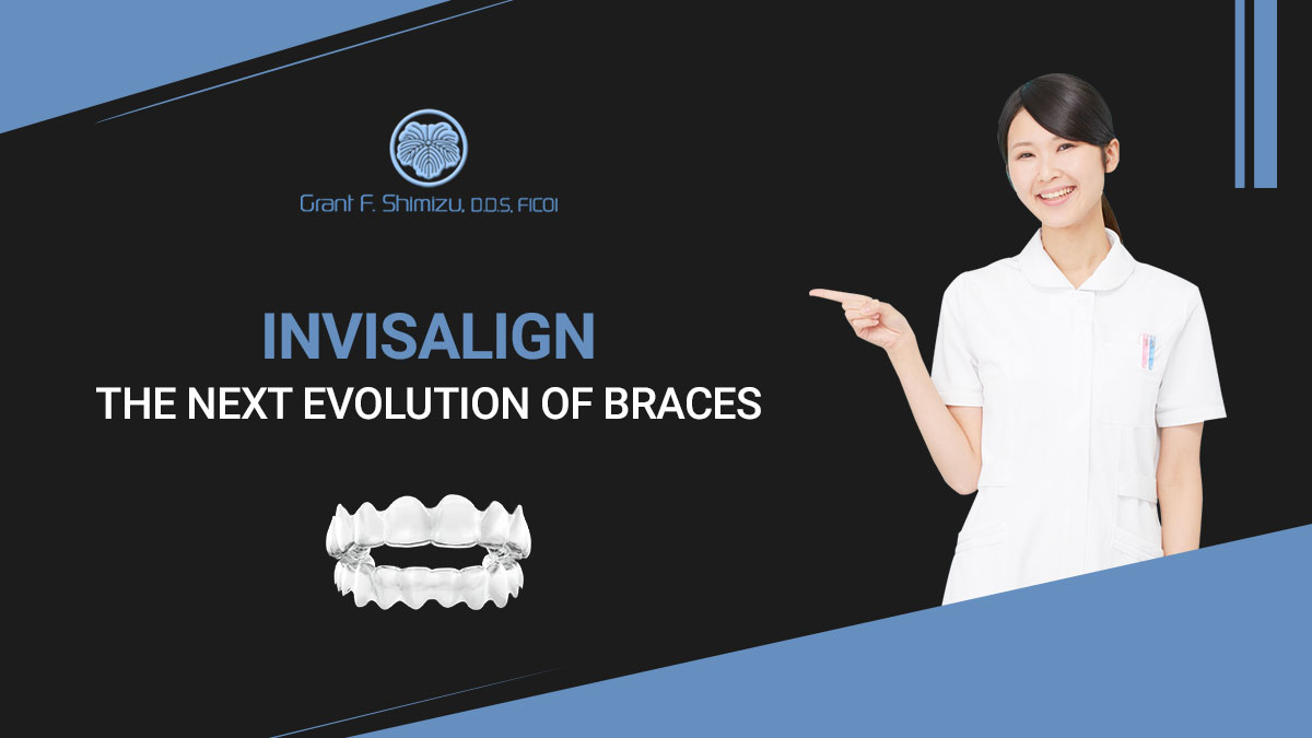 Invisalign: the Next Evolution of Braces