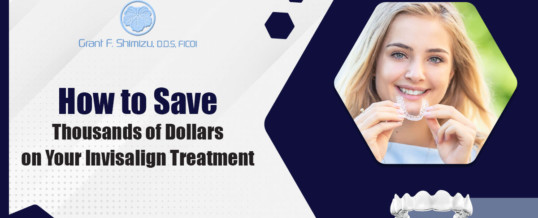 How To Save Thousands Of Dollars On Your Invisalign Treatment