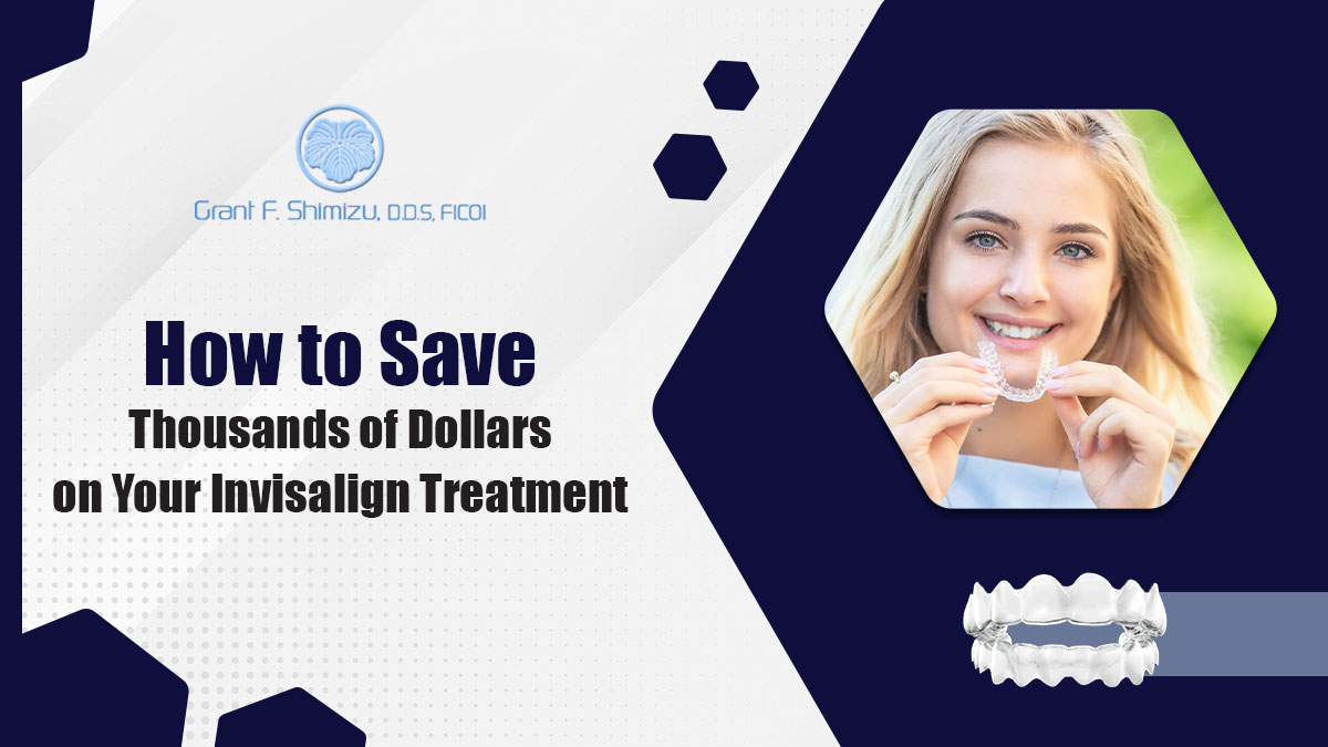 Save Thousands Of Dollars On Your Invisalign Treatment