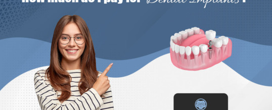 How much do I pay for a dental implant?