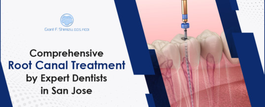 Comprehensive Root Canal Treatment by Expert Dentists in San Jose