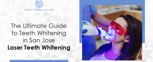 The Ultimate Guide to Teeth Whitening in San Jose: Laser Teeth Whitening