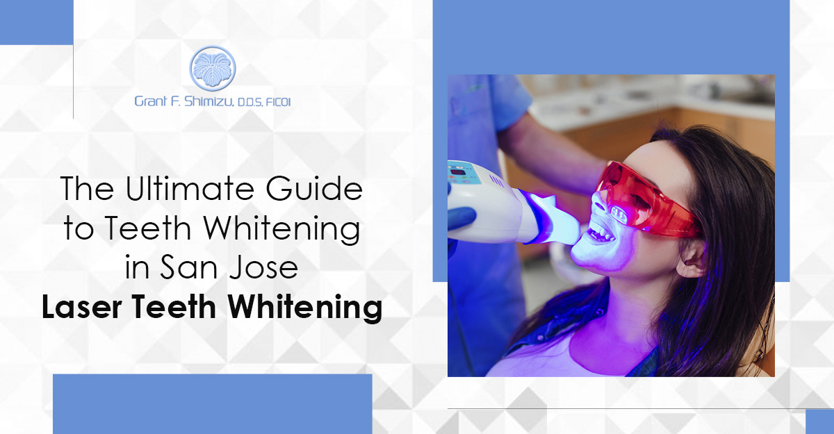 Teeth Whitening in San Jose